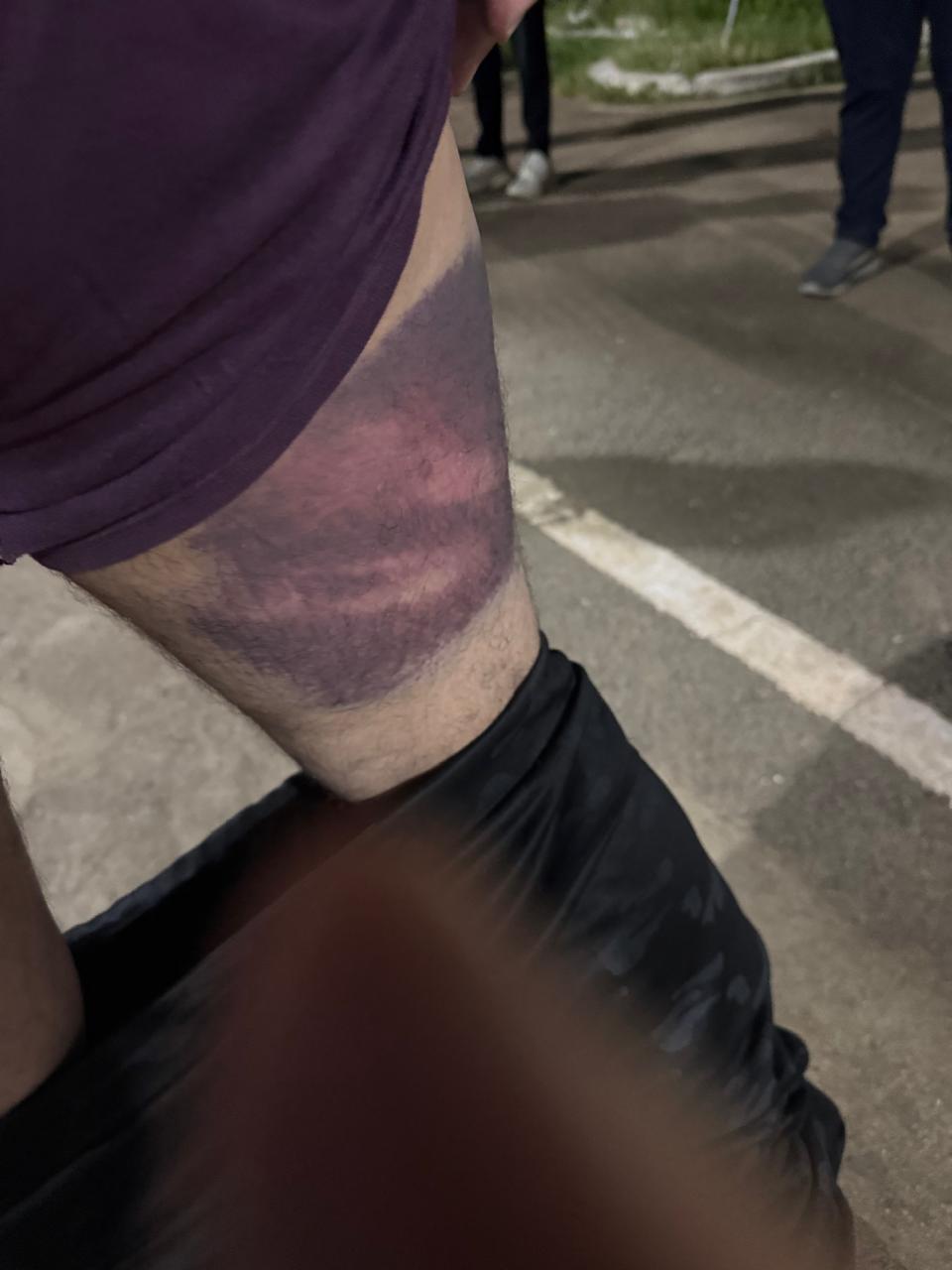 हाईकोर्ट के आदेश से कारोबारी की रिहाई, पुलिस पर पिटाई के गंभीर आरोप 2 1760532151 WhatsApp Image 2025 10 15 at 5.42.46 PM